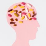 「百健的阿茲海默新藥Lecanemab可以減緩早期阿茲海默症的認知衰退？」之專家意見