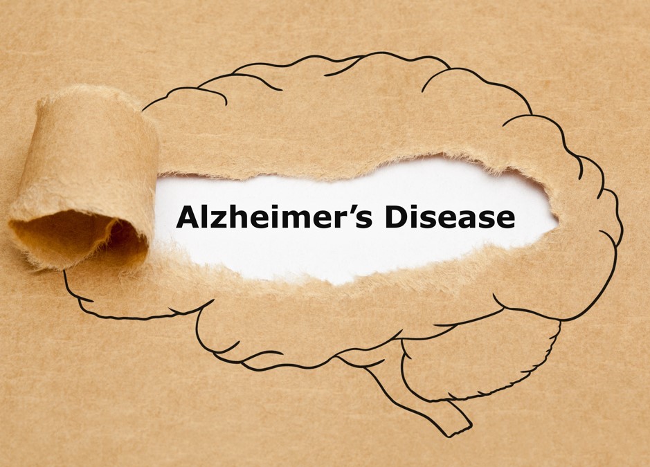 研究抵抗阿茲海默症認知障礙的基因 新聞稿